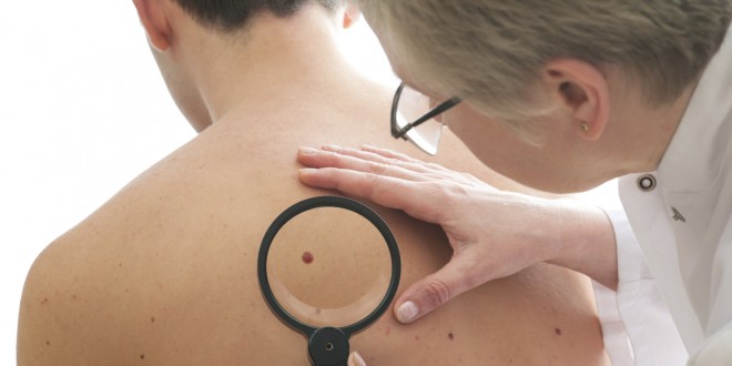 Dermatologist examines a mole